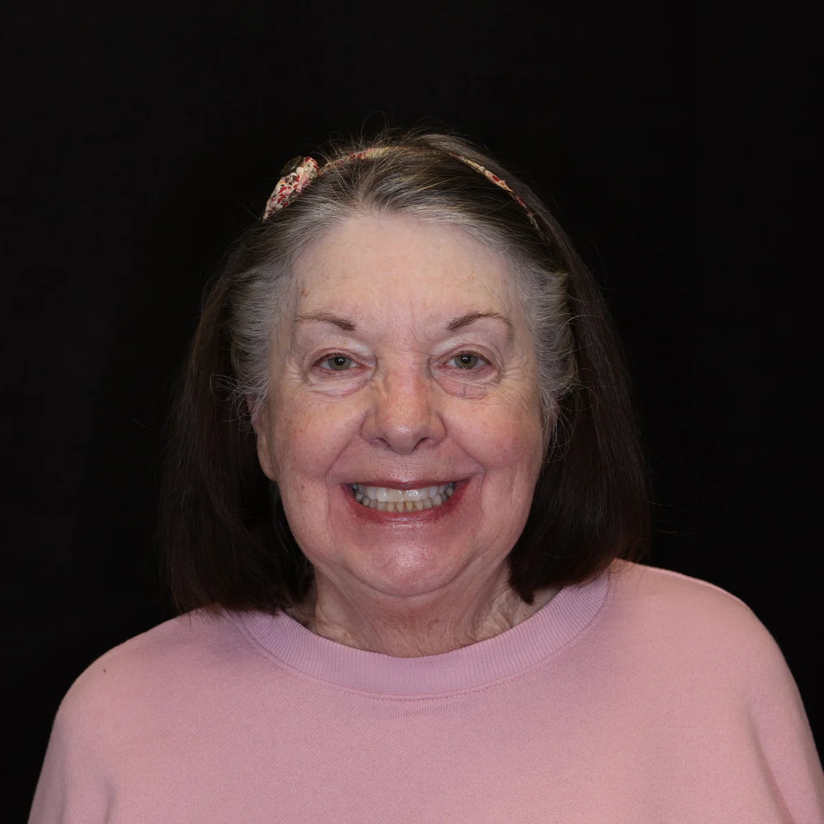 Before — Jackie — Smile Transformation