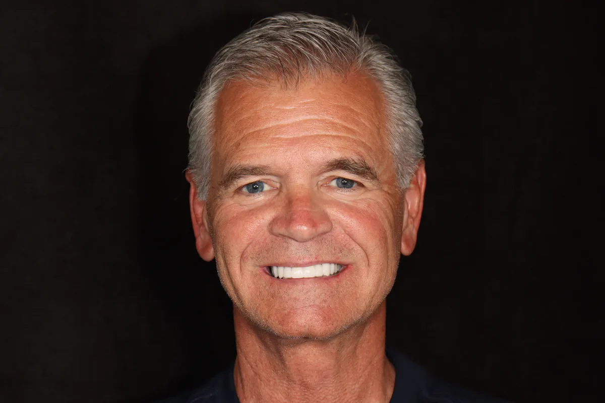 After — Kelly — Smile Makeover
