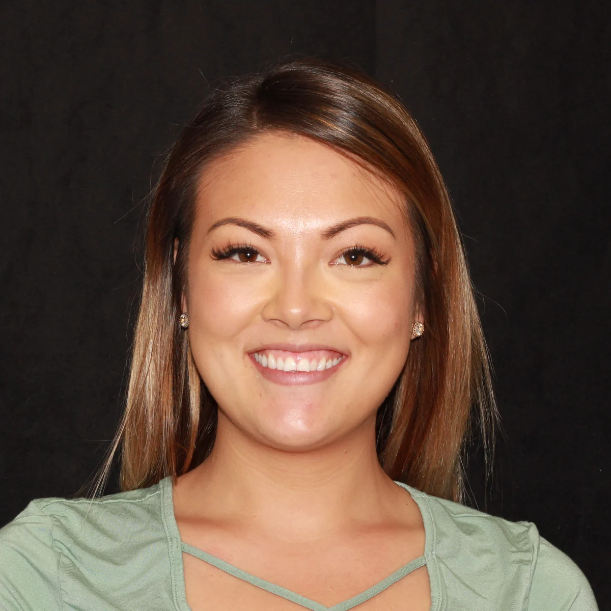 Before — Suzie — Smile Transformation